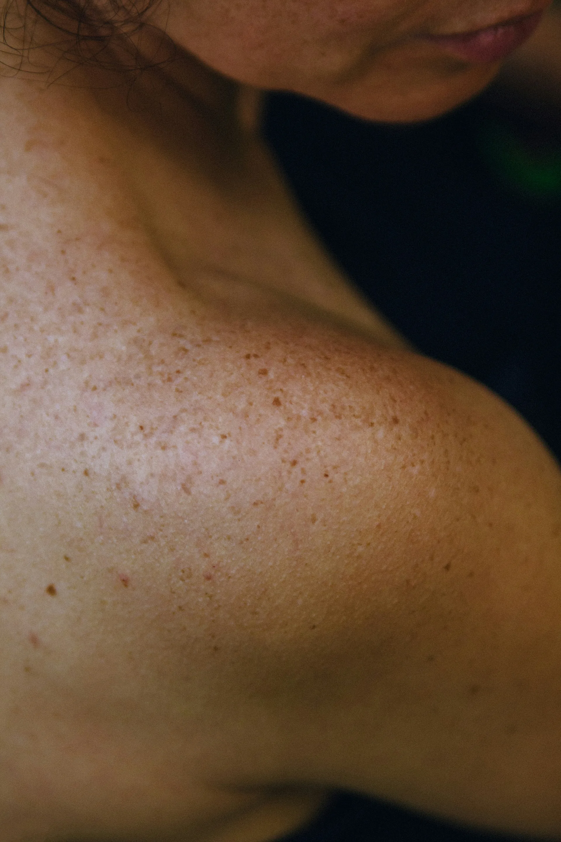 Freckles scattered across a shoulder, read close, like a constellation.