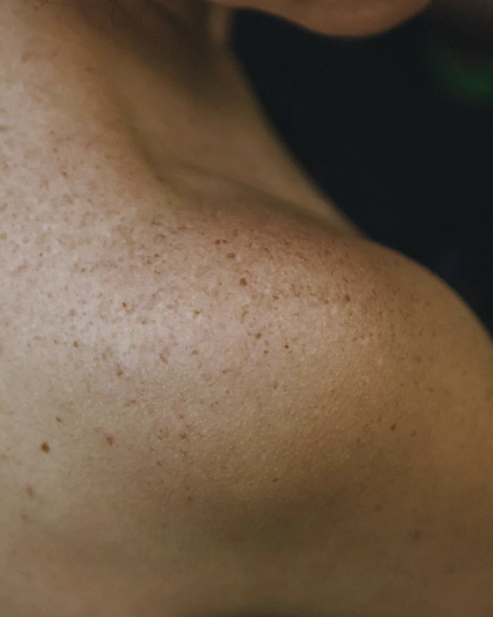 Freckles scattered across a shoulder, read close, like a constellation.